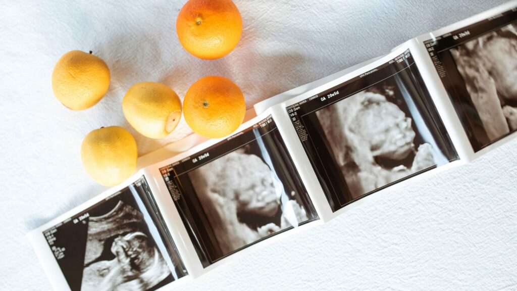 Ultrahangképek sorban elrendezve fehér háttéren, körülöttük citrusfélék, terhességi vizsgálat eredményei és babavárás hangulata.